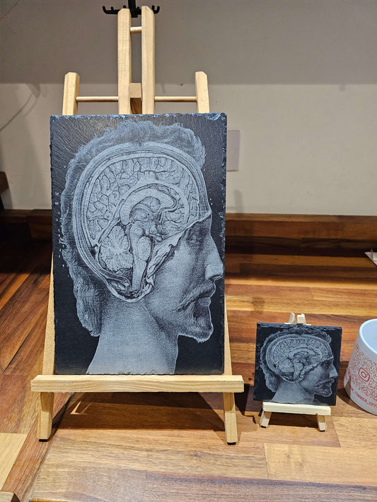 Slate Plaque Anatomical Brain Laser Engraved Wall Art – 30cm x 20cm